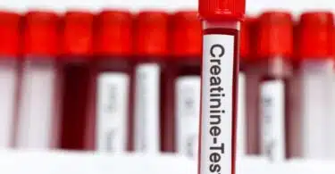 Origine et rôle de la créatinine dans l'organisme